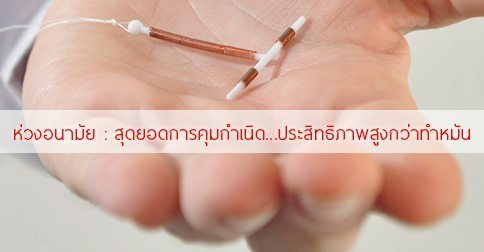 ห่วงอนามัยสำหรับการคุมกำเนิดและป้องกันการตั้งครรภ์ได้อย่างไร